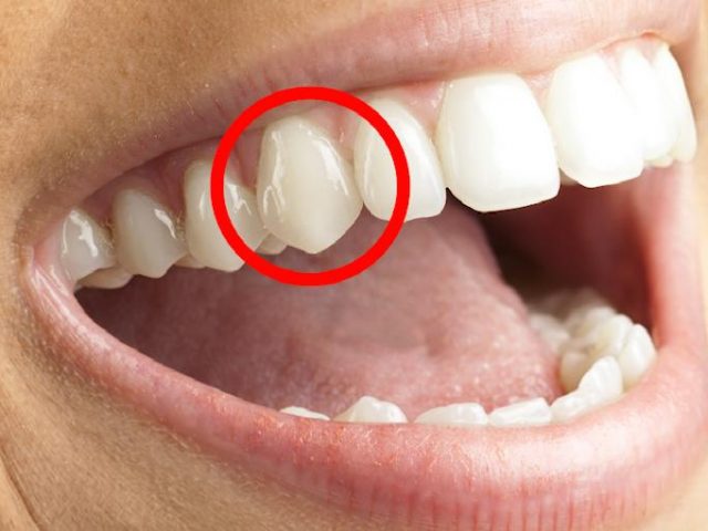 O dente canino é o dente da assertividade de alma e está ligado a ativação das ações em prol do autopreenchimento. A energia do canino está relacionada com nosso aspecto dual onde o ser homem ou mulher supõe um equilíbrio sutil e alquímico entre nosso interior masculino e feminino, vividos no plano dito virtuoso. Está ligado à noção de ESCOLHA, já que são os dentes do movimento, pois é de cada escolha que depende a direção que seguimos na vida. Ligado a impulsão da força produtiva e realizadora.